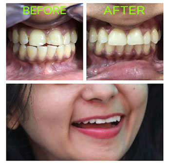 Dental Treatment in Vikaspuri